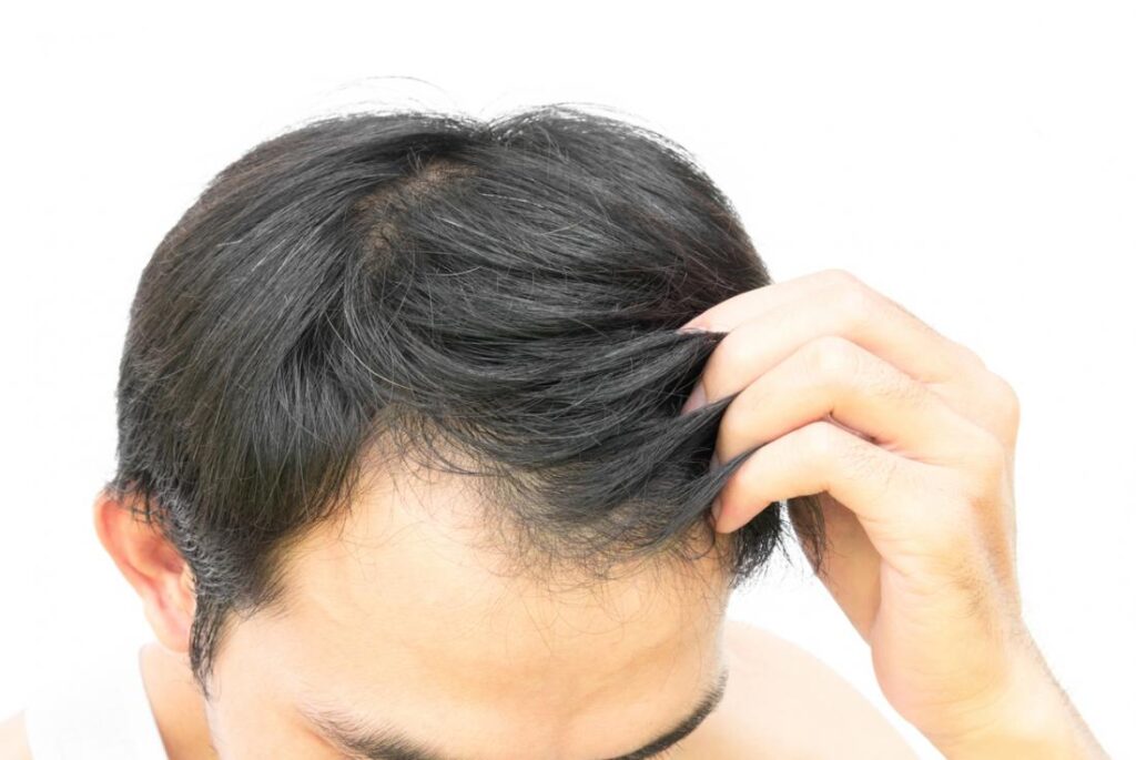 HOW TO GROW YOUR HAIR NATURALLY